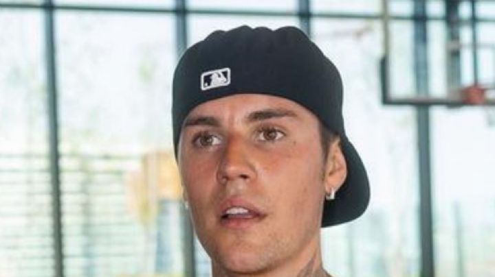 Conoce que es el síndrome de Ramsay Hunt, que sufre Justin Bieber